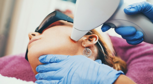 Laser dermatologique